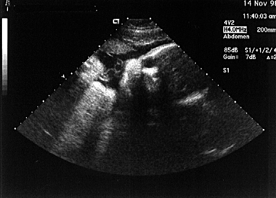 baby1.GIF (172760 bytes)