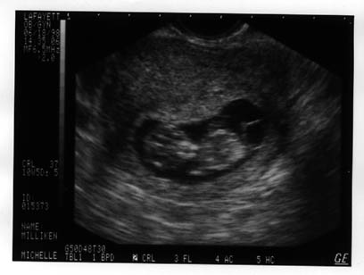 baby1.JPG (18492 bytes)