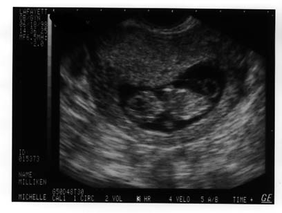 baby2.JPG (20187 bytes)
