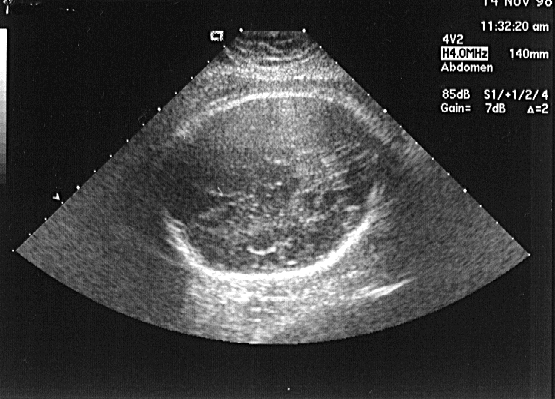 baby4.GIF (202911 bytes)