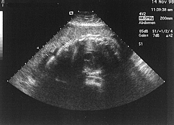 heart.gif (191530 bytes)
