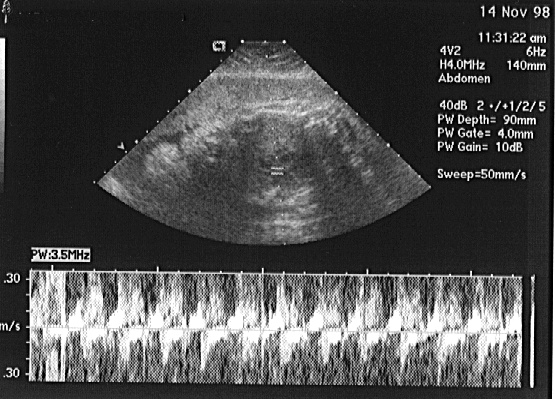heartbeat.gif (204417 bytes)